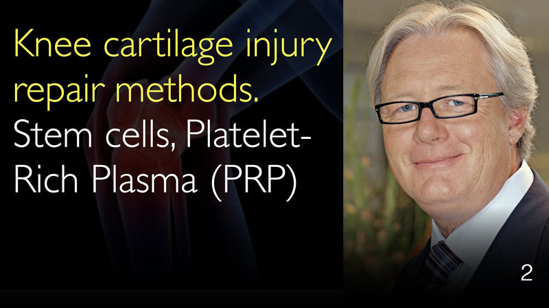 Knee cartilage injury repair methods. Stem cells and Platelet-Rich Plasma (PRP) 2